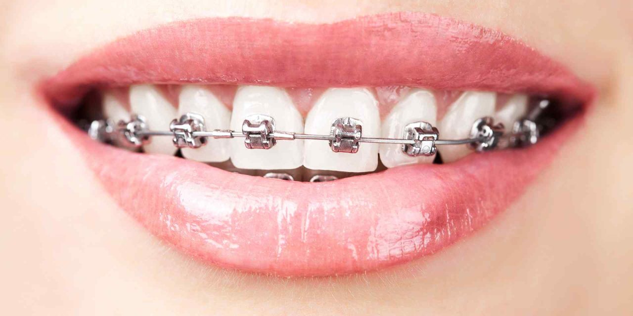 Why Orthodontics?